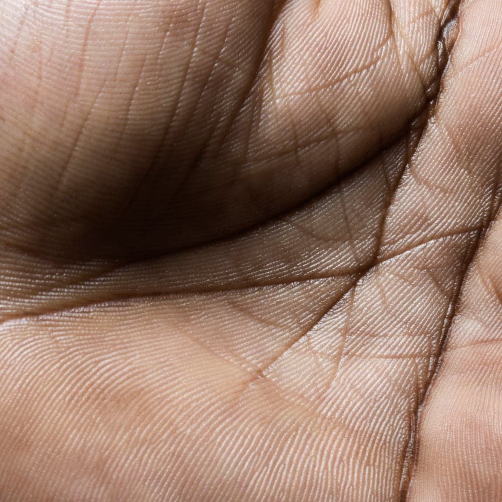 Moderna — Moderna